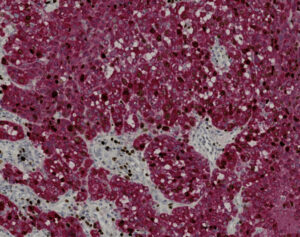 Tissue-Tek Genie<sup>&reg;</sup> DUO anti-Melan-A / Ki67 Antibody Cocktail