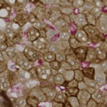 Microscopic image showing polygonal cells with brown and pink staining, highlighting cellular and structural details for histological analysis.
