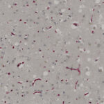 Microscopic image showing numerous small red-stained rod-shaped bacteria scattered among round, translucent cells on a light background.