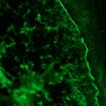 Green fluorescent cells and tissue structures viewed under a microscope, showing a bright edge and mottled texture throughout the image.