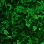Green fluorescent patterns are visible in a microscopic image, showing an irregular distribution across a dark background.