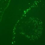 Fluorescent microscopy image showing scattered bright green spots within a dark green background, indicating labeled structures or cells.