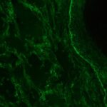 Green fluorescence microscopy image showing fibrous and cellular structures against a dark background, commonly used for viewing tissue samples or cellular components.
