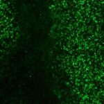 Green fluorescent dots scattered across a dark background, viewed under a microscope, possibly indicating labeled cells or particles.