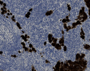 Tissue-Tek Genie<sup>&reg;</sup> anti-ALK (Heme)