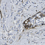 Microscopic image of tissue showing stained cells with brown and blue coloration, displaying varying cell densities and structures.