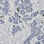 Microscopic image of tissue stained to show cell nuclei in blue and scattered brown signals indicating specific marker presence.