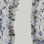Microscopic image of tissue sections showing elongated cells with dark-stained nuclei and lighter cytoplasm, separated by a clear gap in the center.