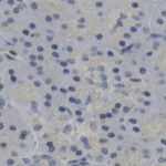 Microscopic view of human pancreatic tissue showing numerous cell nuclei stained dark blue against a light background.
