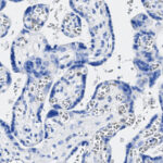 Microscopic image of tissue stained with hematoxylin and eosin, showing blue-purple cell nuclei and cytoplasm in a clustered, branching pattern.