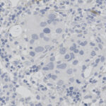 Microscopic view of stained cellular tissue showing clusters of cells with prominent nuclei and surrounding extracellular matrix.