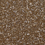 Microscopic view of numerous brown-stained cells with irregular shapes and sizes, densely packed across the field.