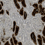 Microscopic image showing kidney tissue with dark brown-stained regions indicating protein expression, and lighter areas representing unstained or less active tissue.