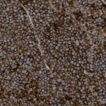 A microscopic view of densely packed polygonal cells with brown borders and blue-purple centers, showing a uniform, honeycomb-like tissue structure.