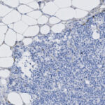 Microscopic image showing a cluster of small, densely packed blue-stained cells adjacent to larger, empty-looking white adipose cells.