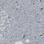 Microscopic image of tissue section showing numerous small, round, blue-stained nuclei and scattered brown-stained areas on a pale background.