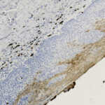 Microscopic image of tissue section stained to highlight brown immunohistochemical markers along the edge, with blue-stained cell nuclei visible throughout the sample.