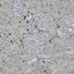 Microscopic image of kidney tissue showing glomeruli and tubules with stained cell nuclei, highlighting cellular structures for histological analysis.