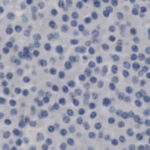 Microscopic view of numerous round, blue-stained cells evenly distributed across a light background.