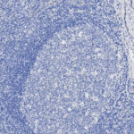 Microscopic image of tissue stained with hematoxylin, showing densely packed blue cells with a lighter oval-shaped region in the center.