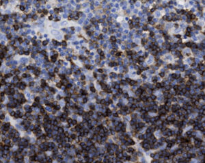 Tissue-Tek Genie<sup>&reg;</sup> anti-CD1a