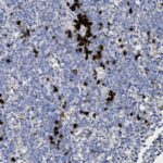 Microscopic image of tissue stained with brown markers highlighting specific cells among a larger number of blue-stained cells.