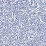 Microscopic view of numerous small, round, purple-stained cells densely packed together on a light background.