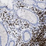 Microscopic view of tissue with several oval-shaped structures and densely clustered dark-stained cells scattered throughout the image.