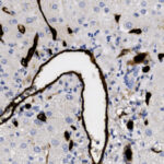 Microscopic image showing a blood vessel in tissue, with cell nuclei stained blue and vessel walls stained dark brown.