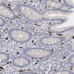 Microscopic image of stained intestinal tissue showing glandular structures with darkly stained nuclei and lightly stained cytoplasm.
