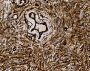 Tissue-Tek Genie<sup>&reg;</sup> anti-CD34