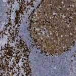 Microscopic image showing clusters of densely packed brown-stained cells and lighter blue areas, likely indicating a tissue sample with specific cellular markers.