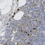 Microscopic image showing tissue section with brown-stained immune cells, blue-stained nuclei, and white adipose tissue areas on the left.