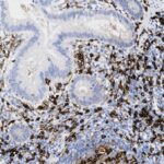 Microscopic view of tissue sample showing cells stained in varying shades of brown and blue for histological examination.
