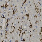 Microscopic view of brain tissue showing dark brown abnormal protein deposits and scattered blue-stained cell nuclei.
