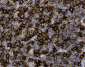 Tissue-Tek Genie<sup>&reg;</sup> anti-CD5