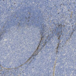 Microscopic view of tissue sample stained blue with scattered darker structures and fibrous patterns, displaying cellular and structural detail.