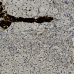 Microscope image showing tissue with a dense, dark brown linear structure near the top and lighter, irregularly shaped cells scattered throughout the field.