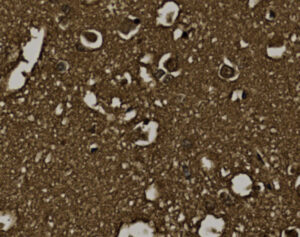 Tissue-Tek Genie<sup>&reg;</sup> anti-CD57