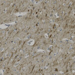 Microscopic view of brain tissue stained to highlight individual cells and fibers; small, round, and elongated structures are visible against a brownish background.