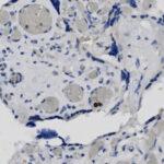 A blue and white cell.