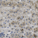 Microscopic view of tissue section showing numerous blue-stained cell nuclei and scattered brown-stained regions.