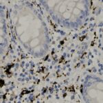 Microscopic image shows tissue with oval-shaped cell clusters and scattered dark brown and blue stained cells.