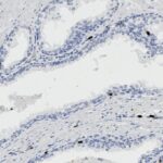 Microscopic image showing tissue with blue-stained cell nuclei and some dark brown spots, likely indicating immunohistochemical staining. White spaces separate cell clusters.