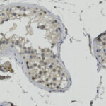 Microscopic image of tissue showing clusters of cells with dark-stained nuclei and light cytoplasm, surrounded by a pale background.