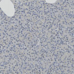 Microscopic view of tissue sample showing numerous round, dark-stained cell nuclei scattered throughout a pale background.
