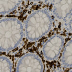 Microscopic image showing stained cross-sections of glandular tissue, with brown-stained cells surrounding circular gland structures.