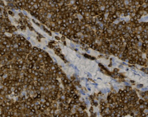 Tissue-Tek Genie<sup>&reg;</sup> anti-CD79a