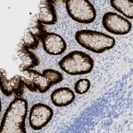 Microscopic image of a tissue section showing glandular structures with dark-stained outlines and clusters of cells on a light background.
