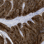 Microscopic image of tissue section stained to show cellular structures, with dark brown and light blue areas highlighting different types of cells and tissue organization.